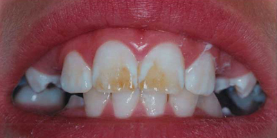 smile-03-b